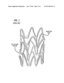 ASPECT RATIO FOR STENT STRUT DESIGN diagram and image