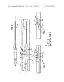 ASPECT RATIO FOR STENT STRUT DESIGN diagram and image