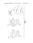 STENT HAVING A BRIDGE STRUCTURE diagram and image