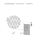 STENT HAVING A BRIDGE STRUCTURE diagram and image