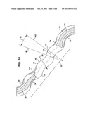 STENT HAVING A BRIDGE STRUCTURE diagram and image