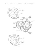 DEVICES, SYSTEMS, AND METHODS FOR RESHAPING A HEART VALVE ANNULUS diagram and image