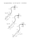 DEVICES, SYSTEMS, AND METHODS FOR RESHAPING A HEART VALVE ANNULUS diagram and image