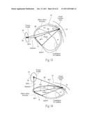 DEVICES, SYSTEMS, AND METHODS FOR RESHAPING A HEART VALVE ANNULUS diagram and image