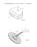 DEVICES, SYSTEMS, AND METHODS FOR RESHAPING A HEART VALVE ANNULUS diagram and image