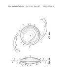 ANTI-DYSPHOTOPIC INTRAOCULAR LENS AND METHOD diagram and image