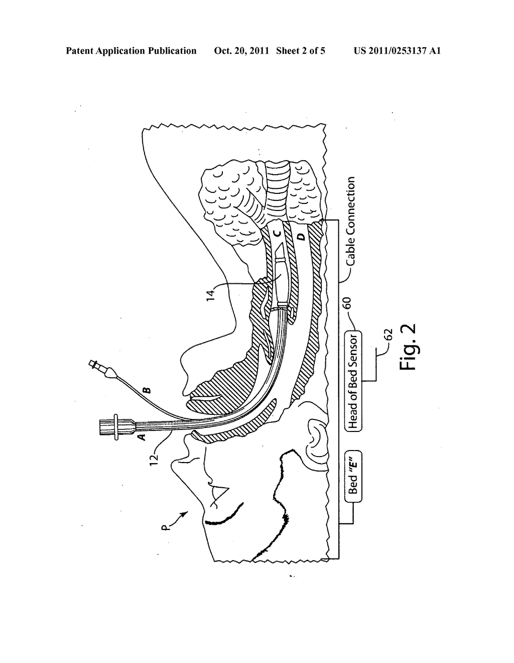 System to control a patient's ventilator or anesthesia machine - diagram, schematic, and image 03