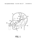 ADJUSTABLE HEADGEAR diagram and image