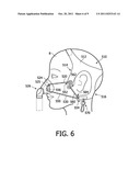 ADJUSTABLE HEADGEAR diagram and image