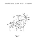 ADJUSTABLE HEADGEAR diagram and image