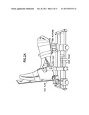 POSITIONING DEVICE FOR ANKLE JOINT REPLACEMENT SURGERY diagram and image