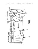 POSITIONING DEVICE FOR ANKLE JOINT REPLACEMENT SURGERY diagram and image