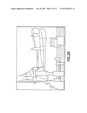 POSITIONING DEVICE FOR ANKLE JOINT REPLACEMENT SURGERY diagram and image