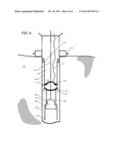 MODIFYING EXPANSION FORCES BY ADDING COMPRESSION diagram and image