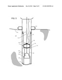 MODIFYING EXPANSION FORCES BY ADDING COMPRESSION diagram and image