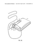 Cord Management System diagram and image