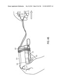 Cord Management System diagram and image