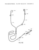 Cord Management System diagram and image