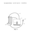 Apparatus and Method for Post Heat Treating Pipe or Weld Joints diagram and image