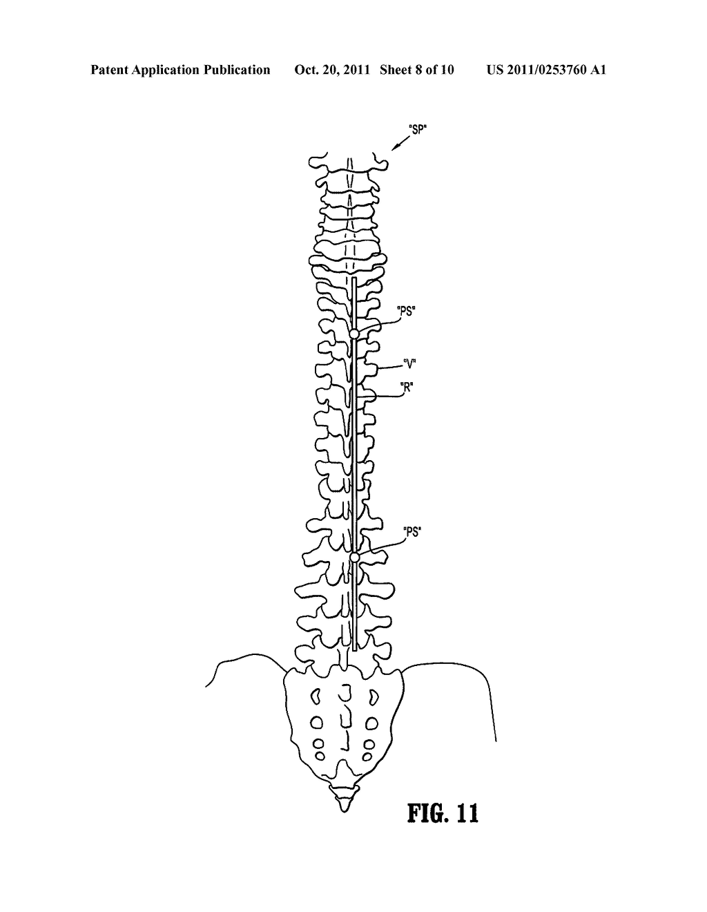 SURGICAL ROD SCORER AND METHOD OF USE OF THE SAME - diagram, schematic, and image 09