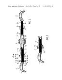 Tensioning device for chains diagram and image