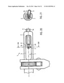 Tensioning device for chains diagram and image