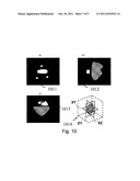 OPTRONIC SYSTEM AND METHOD DEDICATED TO IDENTIFICATION FOR FORMULATING     THREE-DIMENSIONAL IMAGES diagram and image