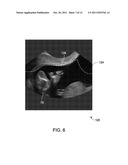 METHOD AND SYSTEM FOR DETERMINING A REGION OF INTEREST IN ULTRASOUND DATA diagram and image