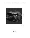 METHOD AND SYSTEM FOR DETERMINING A REGION OF INTEREST IN ULTRASOUND DATA diagram and image