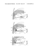 Manufacturing method for closed vane wheels diagram and image