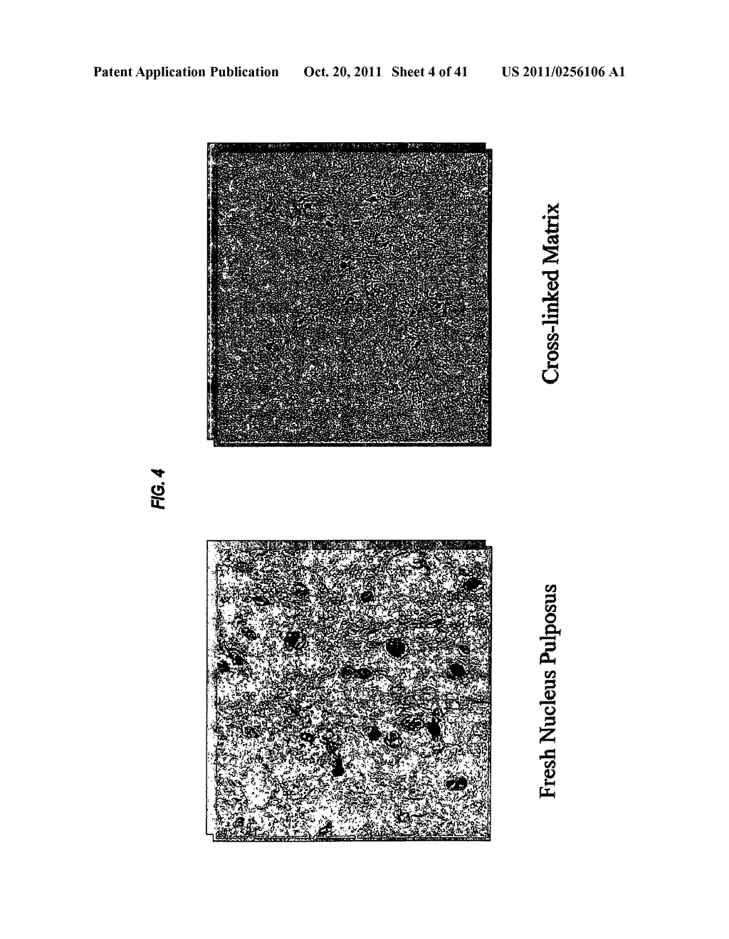 Methods and Compositions for Treating Intervertebral Disc Degeneration - diagram, schematic, and image 05