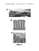 RECOMBINANT BACTERIUM CAPABLE OF ELICITING A PROTECTIVE IMMUNE RESPONSE     AGAINST C. PERFRINGENS diagram and image