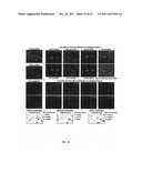 BIOMARKERS FOR PANCREATIC CANCER AND DIAGNOSTIC METHODS diagram and image