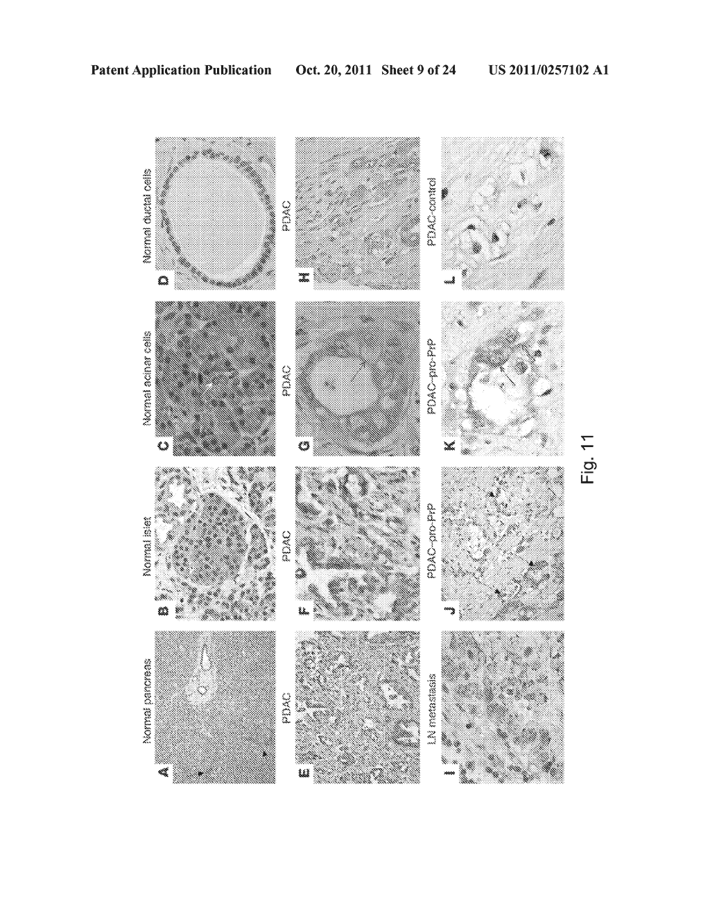 COMPOSITIONS AND METHODS OF TREATING CANCER - diagram, schematic, and image 10