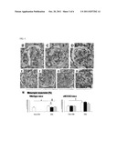 Therapeutic Compositions and Methods for Treating Chronic Kidney Disease     Associated with a Metabolic Imbalance diagram and image