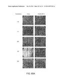 2 x 2 x 2 WEEK DOSING REGIMEN FOR TREATING ACTINIC KERATOSIS WITH     PHARMACEUTICAL COMPOSITIONS FORMULATED WITH 3.75 % IMIQUIMOD diagram and image