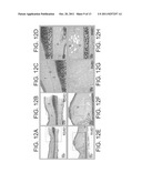 COMPOSITION FOR TREATMENT OF EPITHELIAL TISSUE diagram and image