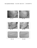 COMPOSITION FOR TREATMENT OF EPITHELIAL TISSUE diagram and image