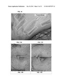 COMPOSITION FOR TREATMENT OF EPITHELIAL TISSUE diagram and image