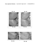 COMPOSITION FOR TREATMENT OF EPITHELIAL TISSUE diagram and image