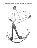 VENTRICULAR FUNCTION ASSISTING DEVICE AND A METHOD AND APPARATUS FOR     IMPLANTING IT diagram and image