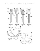 VENTRICULAR FUNCTION ASSISTING DEVICE AND A METHOD AND APPARATUS FOR     IMPLANTING IT diagram and image