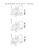 ACTIVE OR PASSIVE ASSISTANCE IN THE CIRCULATORY SYSTEM diagram and image