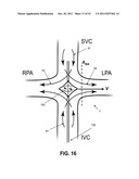 ACTIVE OR PASSIVE ASSISTANCE IN THE CIRCULATORY SYSTEM diagram and image