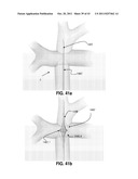 ACTIVE OR PASSIVE ASSISTANCE IN THE CIRCULATORY SYSTEM diagram and image