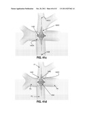 ACTIVE OR PASSIVE ASSISTANCE IN THE CIRCULATORY SYSTEM diagram and image