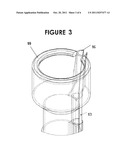 Endoscopic Mucosal Resection (EMR) Over-Sheath and Methods diagram and image