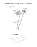 Endoscopic Mucosal Resection (EMR) Over-Sheath and Methods diagram and image