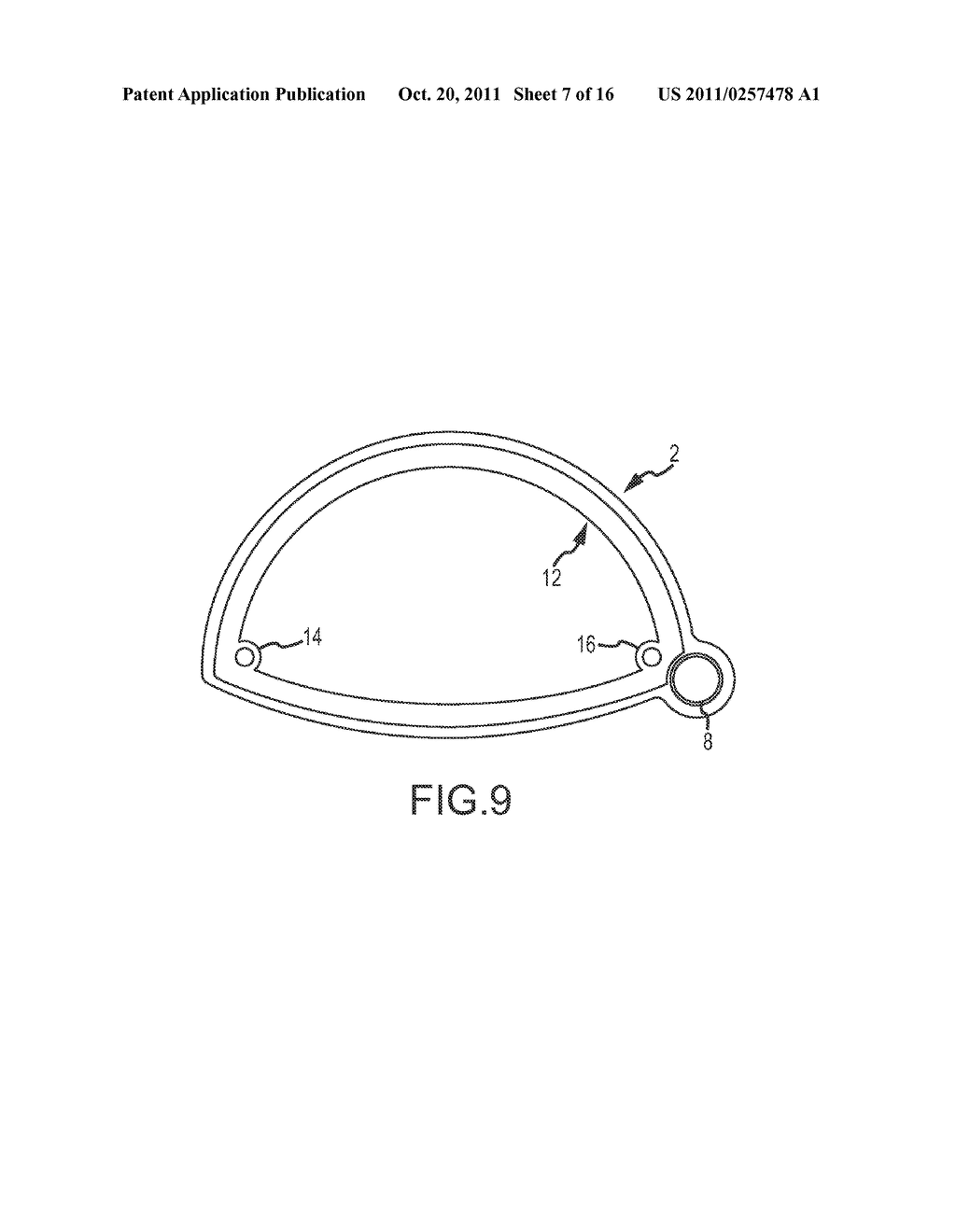 METHOD AND APPARATUS FOR PERFORMING RETRO PERITONEAL DISSECTION - diagram, schematic, and image 08