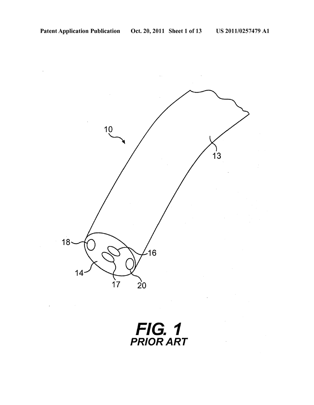 CONTROLLABLE ENDOSCOPIC SHEATH APPARATUS AND RELATED METHOD OF USE - diagram, schematic, and image 02